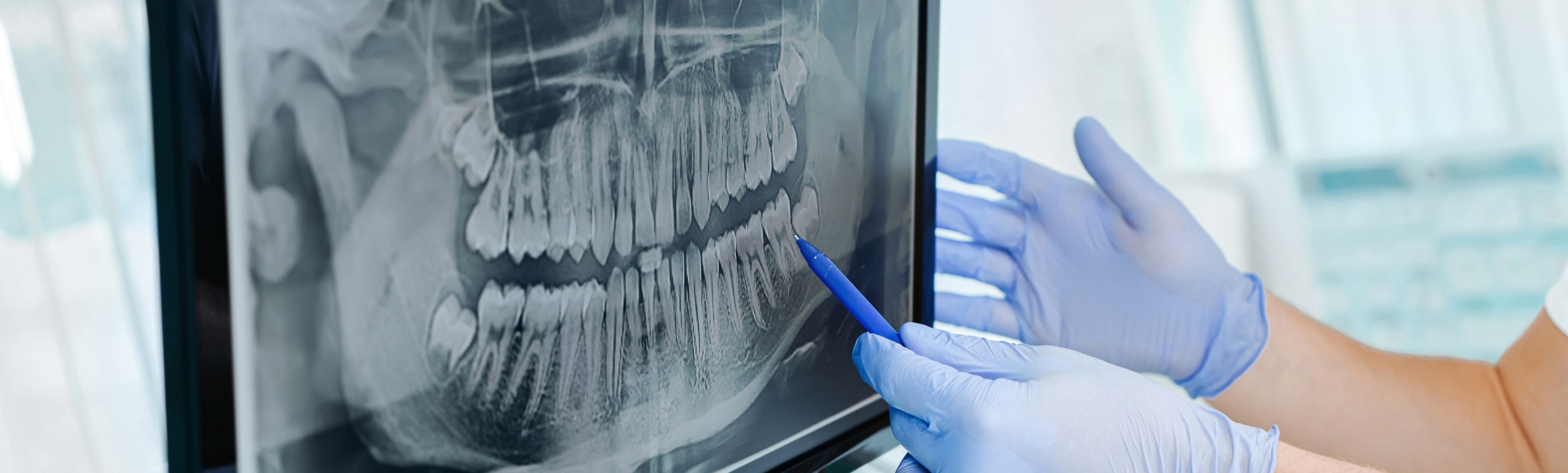 Dental x-ray of patient's teeth